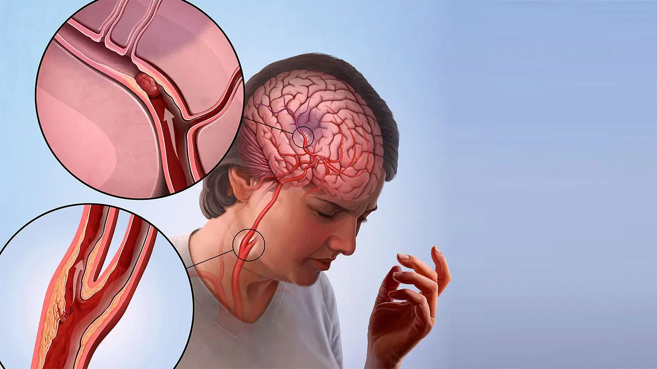 turkiyede bu sebepten dolayi her yil 45 bin insan oluyor YfMVRbaE